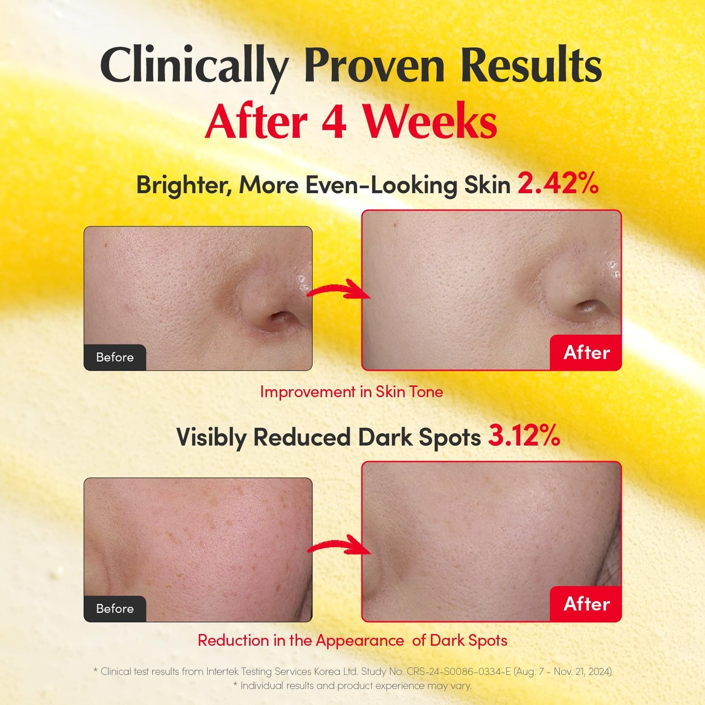 Vitamin Illuminating Dark Spot Serum