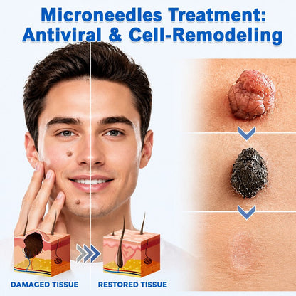 ✨ 2-in-1 Microneedle & Hydrocolloid Patches for Acne & Blemishes | Targeted Face & Body Spot Care