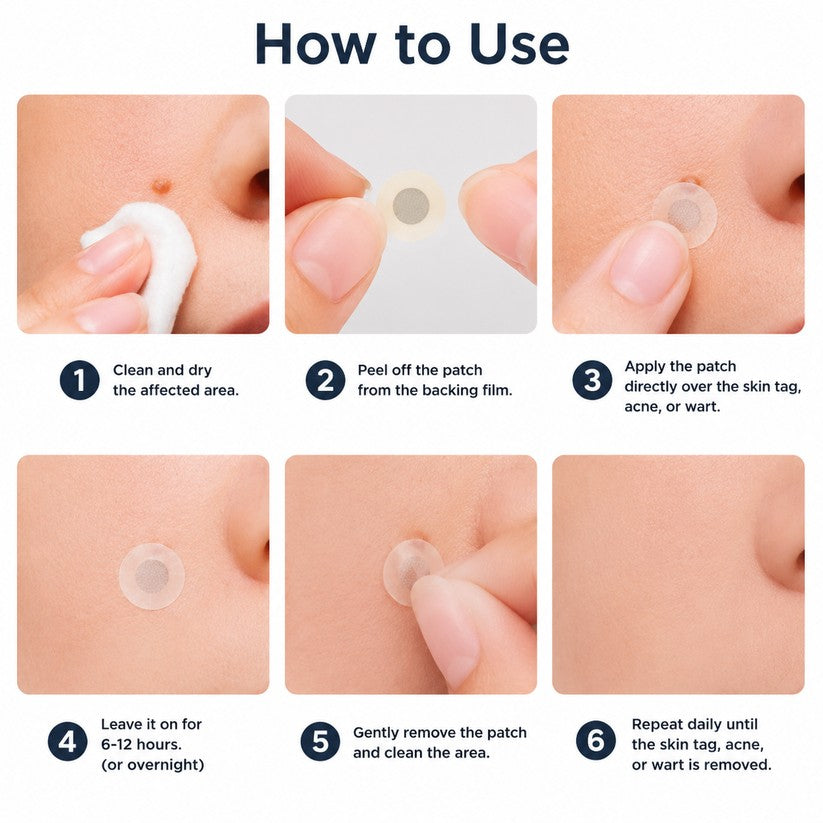 ✨ 2-in-1 Microneedle & Hydrocolloid Patches for Acne & Blemishes | Targeted Face & Body Spot Care