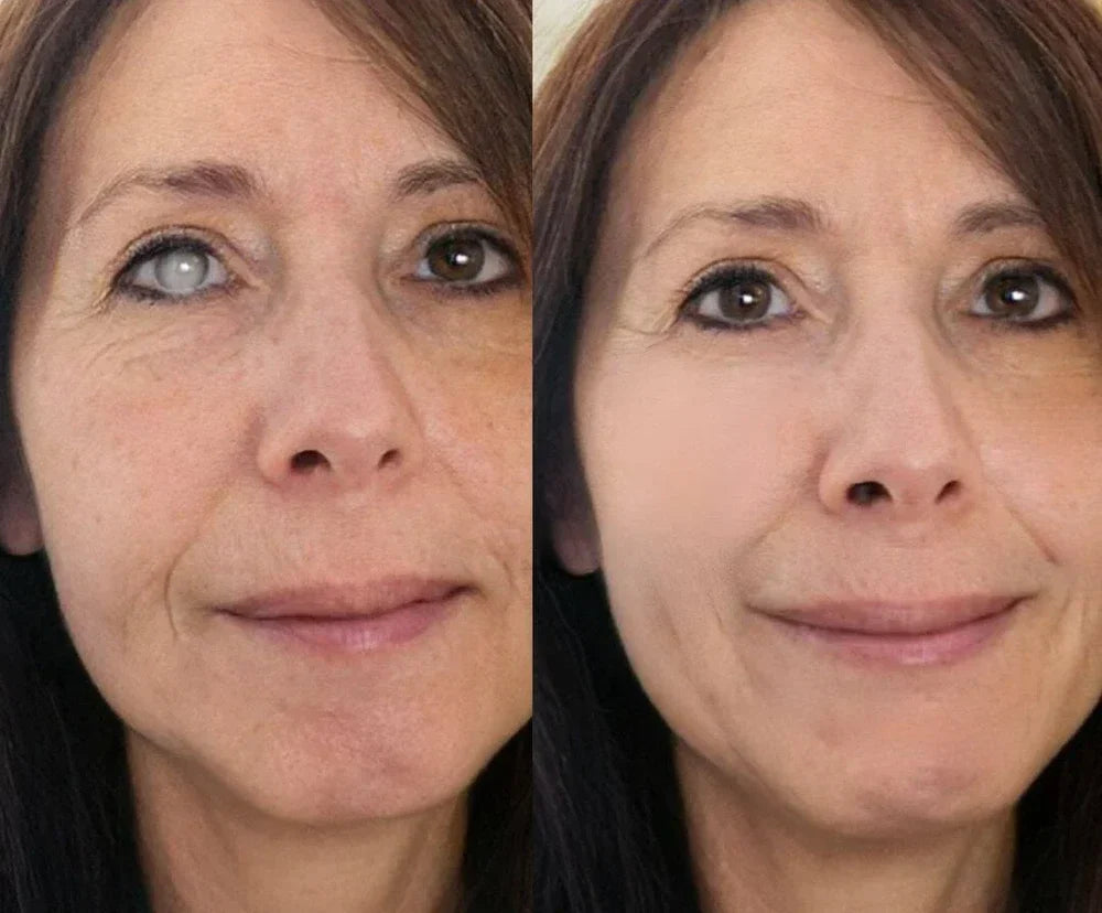 ✨ Cooling Nano Eye Roller Serum | Brighten, Smooth & Refresh Tired-Looking Eyes