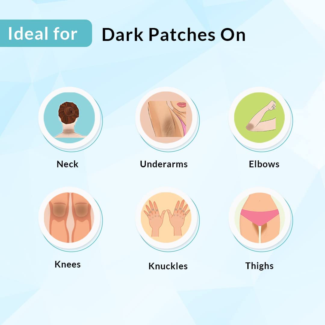 Fix Derma Nigrifix Cream – For Skin Imperfections Associated With Acanthosis Nigricans