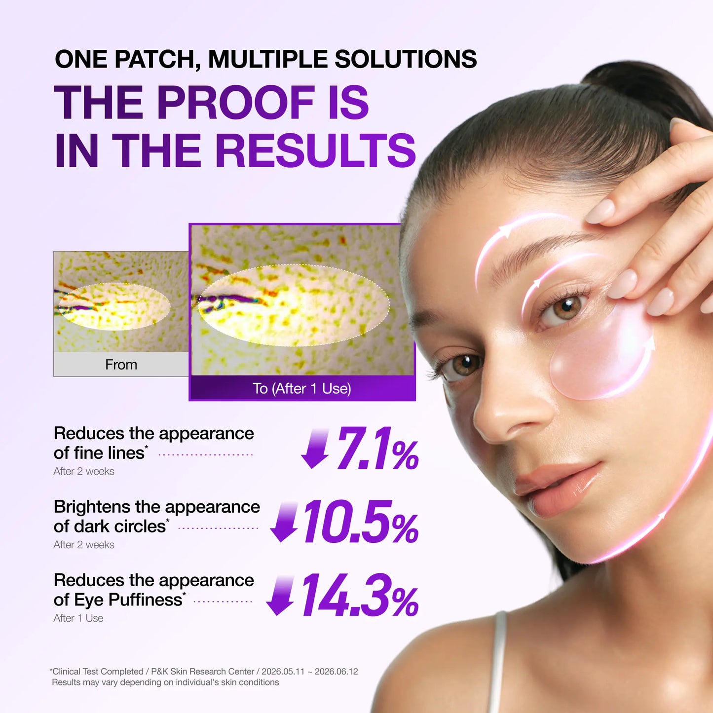 ✨ Complete Eye Revival Duo — Retinol Eye Cream + Berry Eye Patches for Smoother, Brighter-Looking Eyes