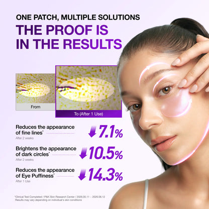 ✨ Complete Eye Revival Duo — Retinol Eye Cream + Berry Eye Patches for Smoother, Brighter-Looking Eyes