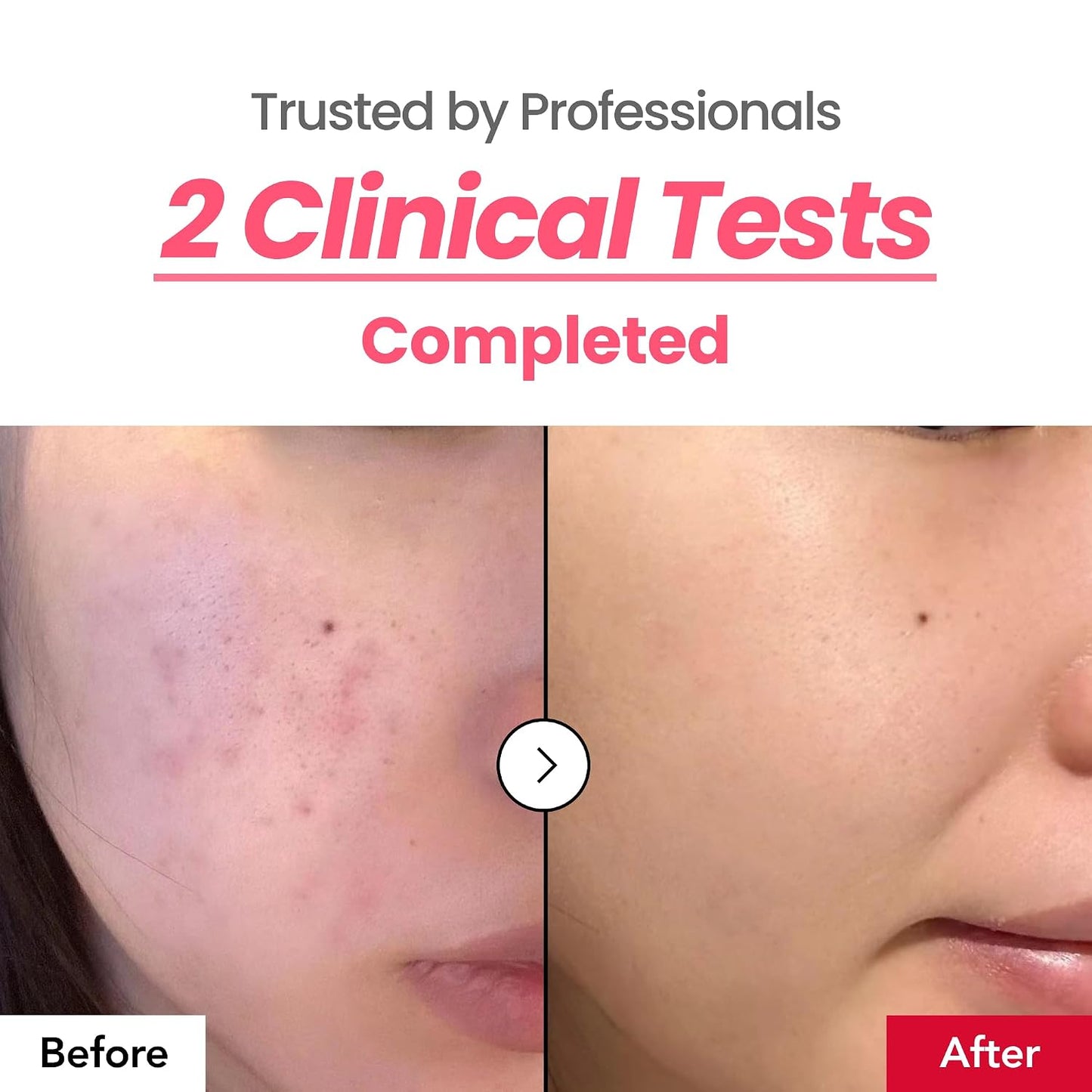 Dark Spot 24% Correcting Pink Glow Cream