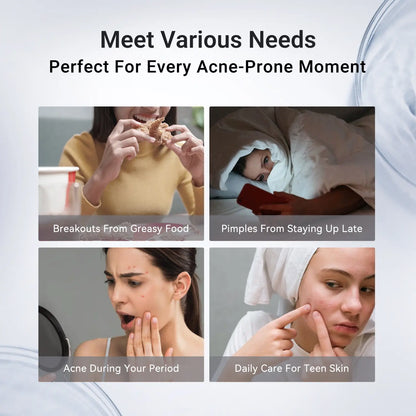 Dr.Leo Acne Buster Salicylic Acid Drying Lotion – Fast-Acting Spot Treatment