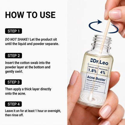 Dr.Leo Acne Buster Salicylic Acid Drying Lotion – Fast-Acting Spot Treatment
