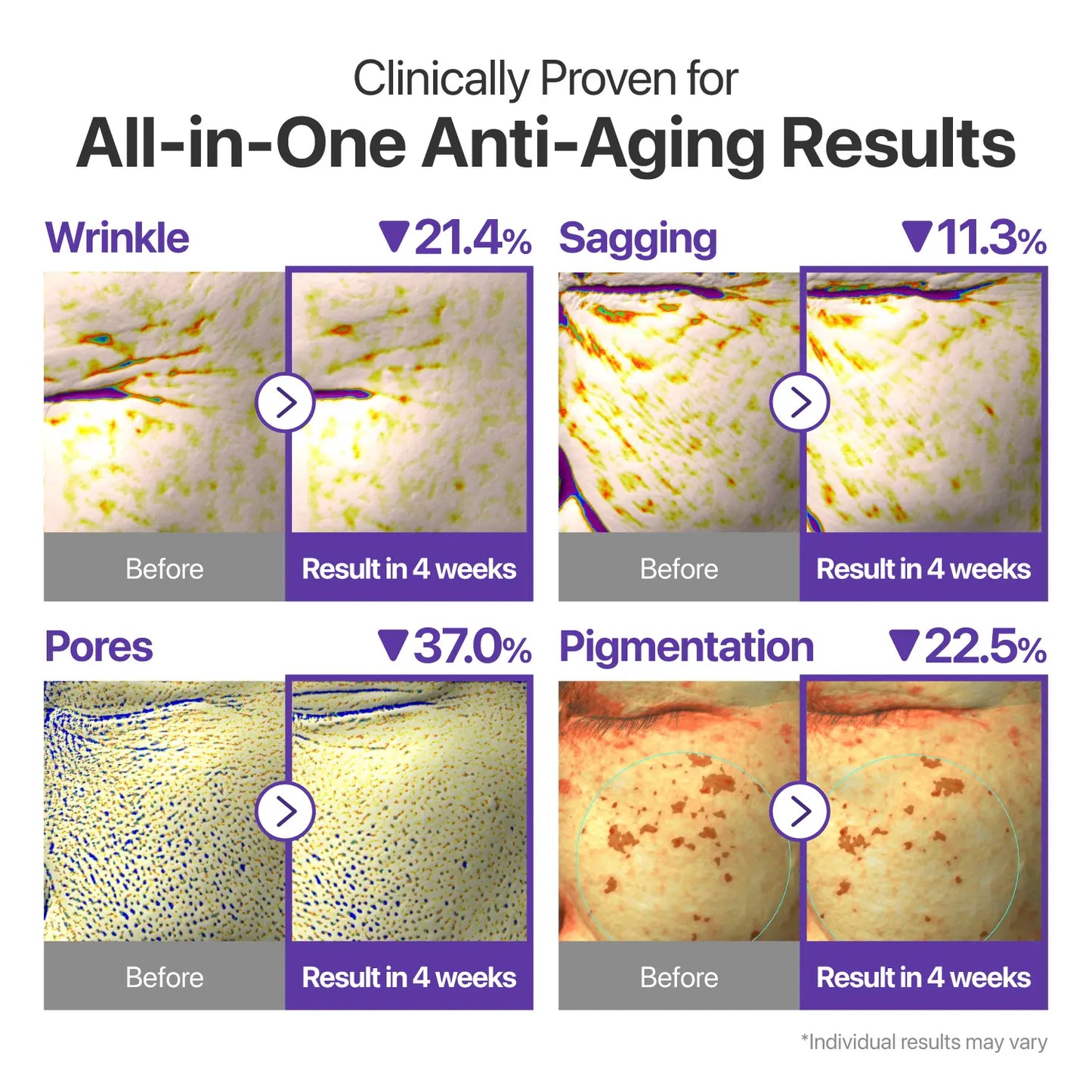 numbuzin No.9 NAD+ Retinal Volumetox Eye Cream Duo Set – All-in-One Anti-Aging Treatment