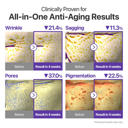 numbuzin No.9 NAD+ Retinal Volumetox Eye Cream Duo Set – All-in-One Anti-Aging Treatment