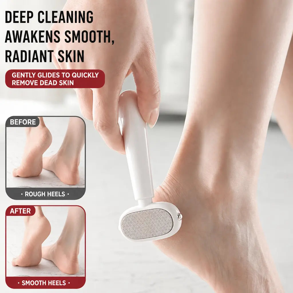 Removedor de callos de doble cara para los pies – Raspador portátil de piel muerta con hojas reemplazables