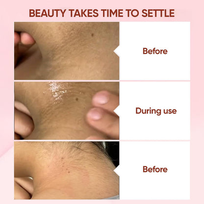 QUARXERY Purifying Exfoliating Gel - Gentle Face & Body Cleanser