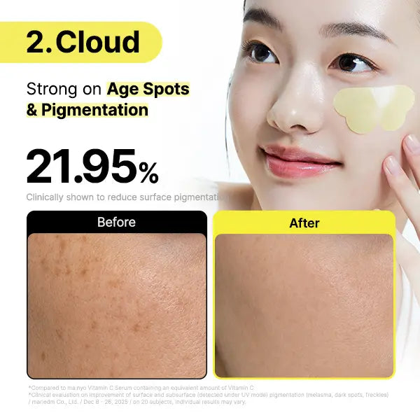 ❤️Glutathione 7 Brightening Dark Spot Patches