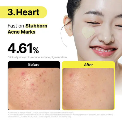 ❤️Glutathione 7 Brightening Dark Spot Patches