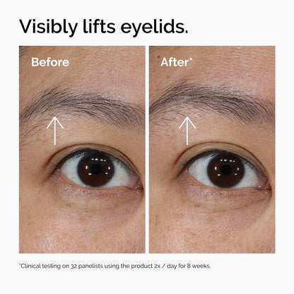 🎀Lacto-PDRN 4% + B9 Eye Cream – Lifting & Firming Eye Treatment
