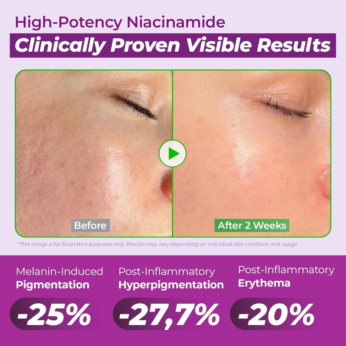 🎉JUMISO 20% Niacinamide Dark Spot Correcting Serum for Face, 1.35 fl oz
