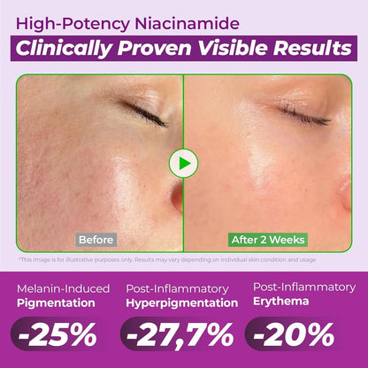 🎉JUMISO 20% Niacinamide Dark Spot Correcting Serum for Face, 1.35 fl oz