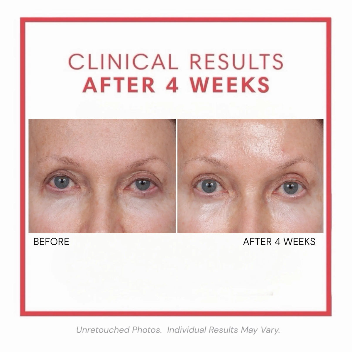 🎀Volumagen™ Volumizing Collagen Eye Cream – Plump. Smooth. Recontour.