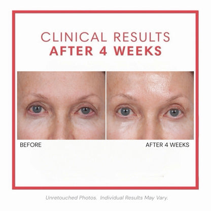 🎀Volumagen™ Volumizing Collagen Eye Cream – Plump. Smooth. Recontour.