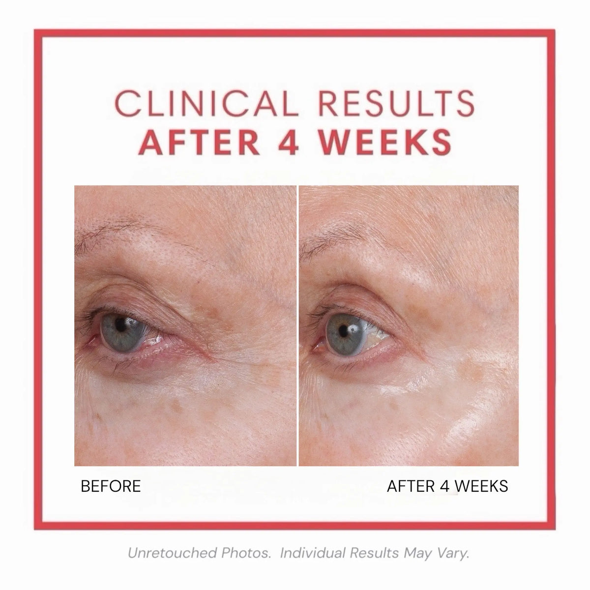 🎀Volumagen™ Volumizing Collagen Eye Cream – Plump. Smooth. Recontour.