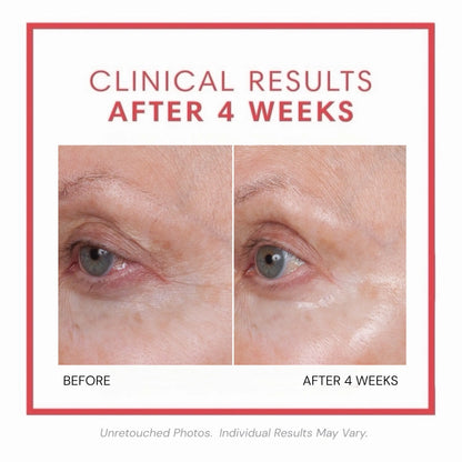 🎀Volumagen™ Volumizing Collagen Eye Cream – Plump. Smooth. Recontour.