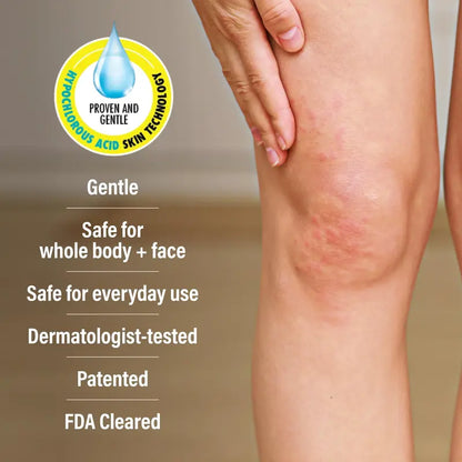 🎀A+D Advanced Dermatitis Care Hydrogel Spray with Hypochlorous Acid