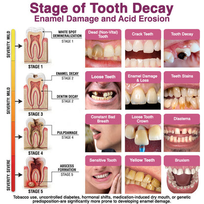 🎀DenPerm Cavity-Repair Natural Enamel Filling Gel