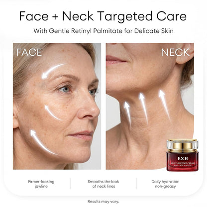 🎉EXH Retinol Face Moisturizer Cream for Women, Anti Aging Collagen Cream with 5 Ceramides & Bifida for Face and Neck