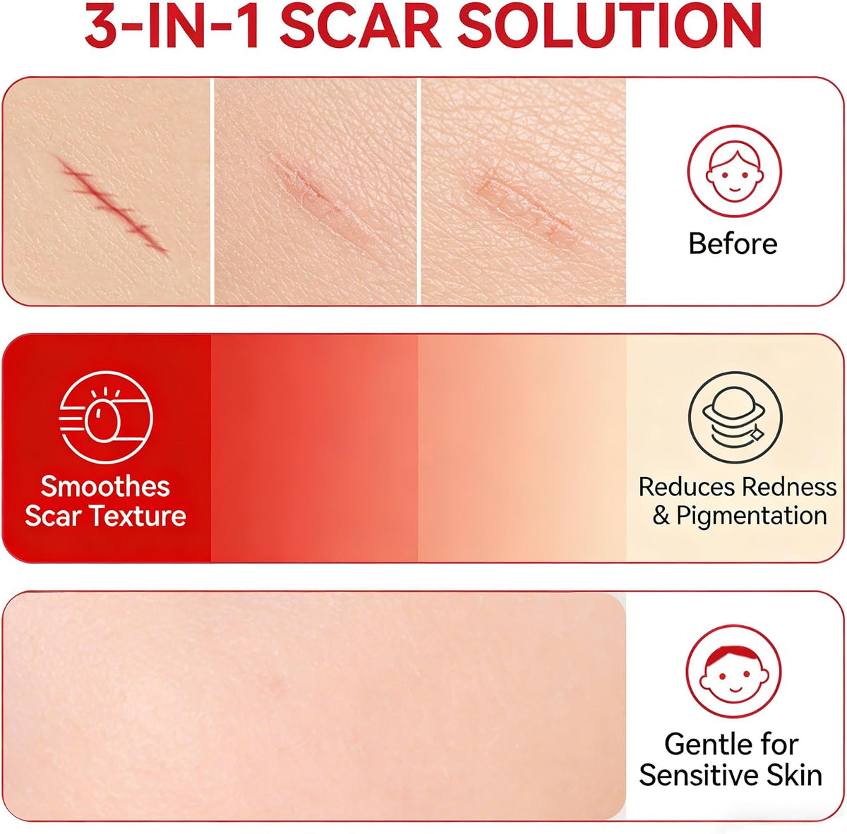 🎉Scar Soothing Cream & Smoothing Cream for Scars