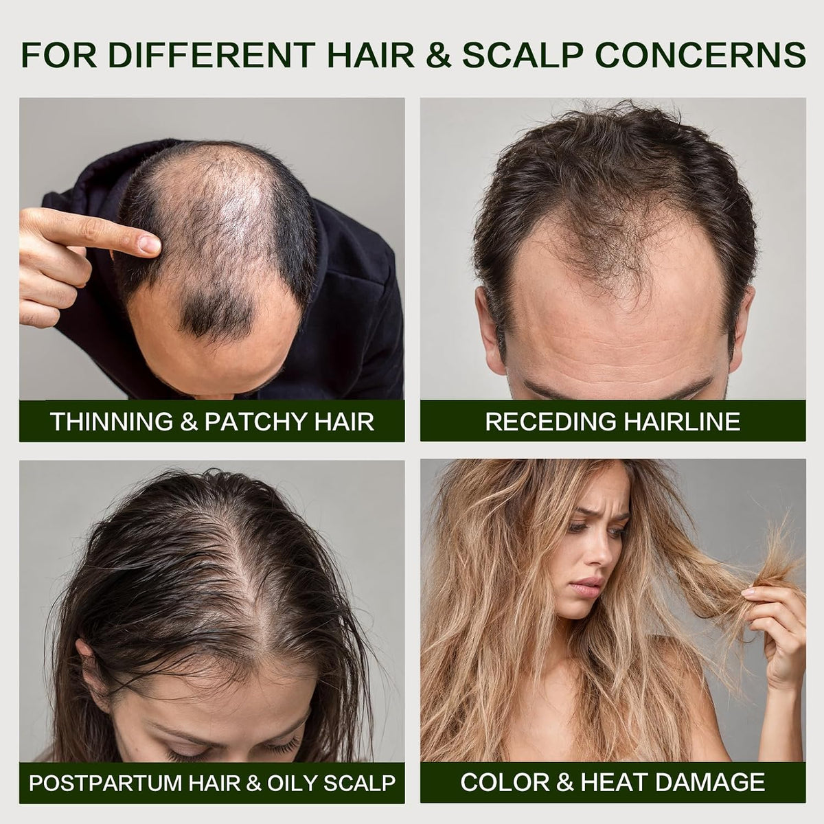 🎀Rosemary Shampoo – Volumizing & Anti-Hair Loss Care
