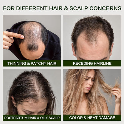 🎀Rosemary Shampoo – Volumizing & Anti-Hair Loss Care