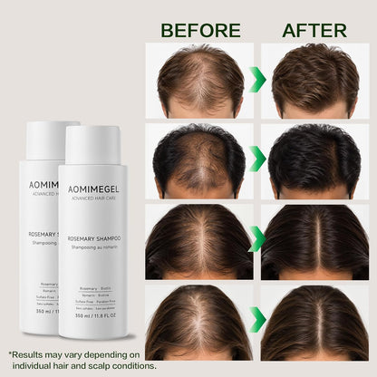 🎀Rosemary Shampoo – Volumizing & Anti-Hair Loss Care