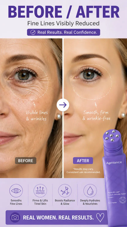 🎉AgeVance Anti-Wrinkle Neck Massage Cream