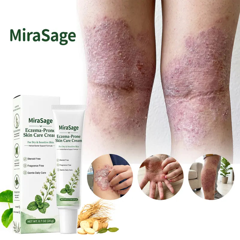 🎀Eczema-Prone Skin Care Cream – Gentle Botanical Daily Care