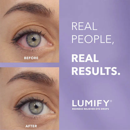 ❤️Fast-Acting Redness Relief Eye Drops – 2.5mL