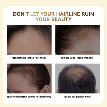 🎉Hairline Shadow Powder