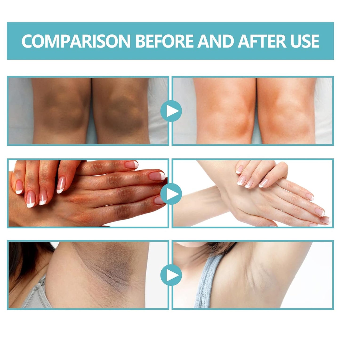 ✨ Targeted Dark Spot Body Cream — Smooth, Exfoliate & Hydrate with Lactic Acid + Retinol