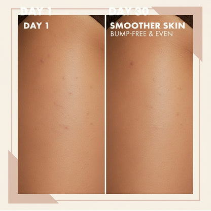 ✨After-Shave Body Oil – Hydrating & Brightening Care for Smoother-Looking Skin