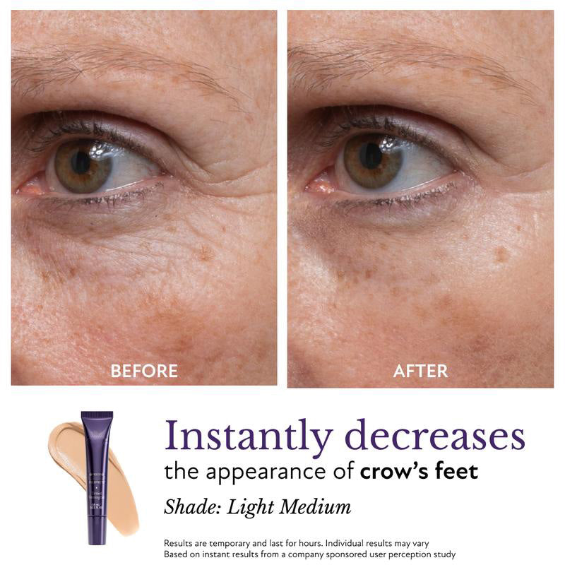 ⏱️Eye Effects-Reduce the Appearance of Puffiness, Fine Lines, Wrinkles, and Under-Eye Circles