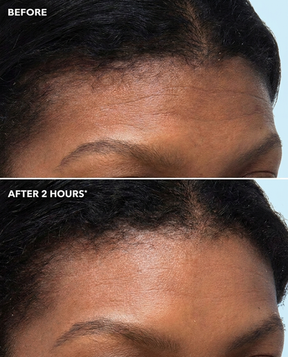 Peptiject Peptide Infused Face + Eye Tape