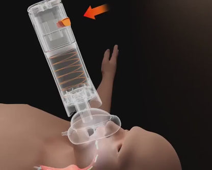 ✨Portable Anti-Choking Suction Device – Manual Emergency Airway Tool