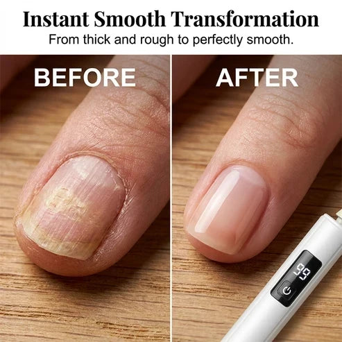Set profesional de torno eléctrico para uñas: herramienta versátil para el cuidado de las uñas con pantalla digital inteligente de velocidad